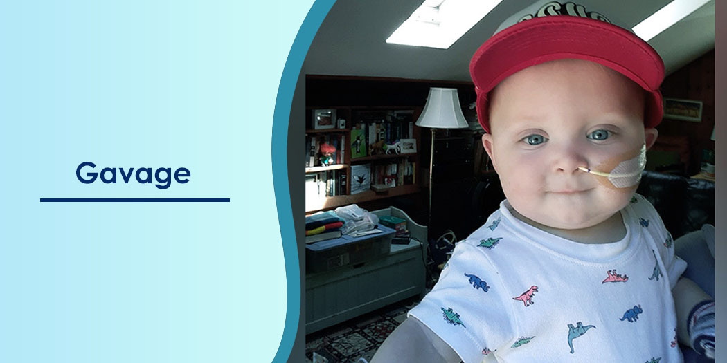 گاواژ چیست؟
