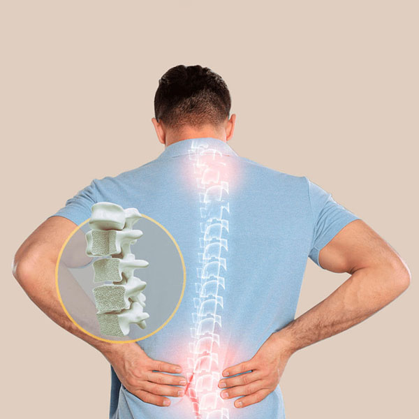 مراقبت ها در پروسه درمان پوکی استخوان